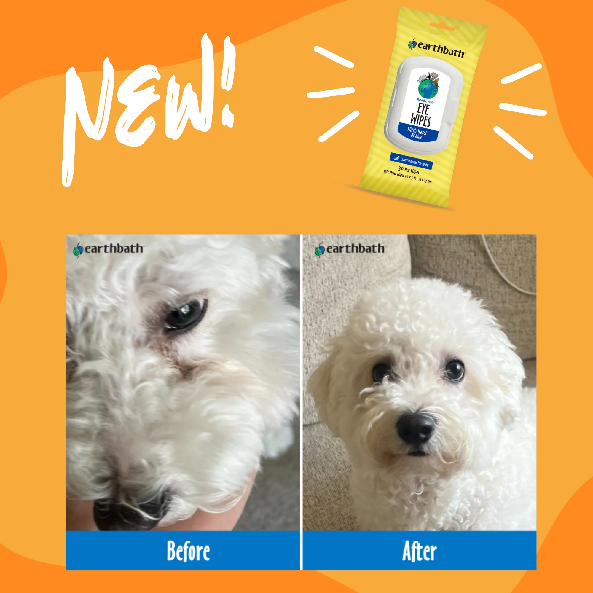 Hypoallergenic Eye Wipes